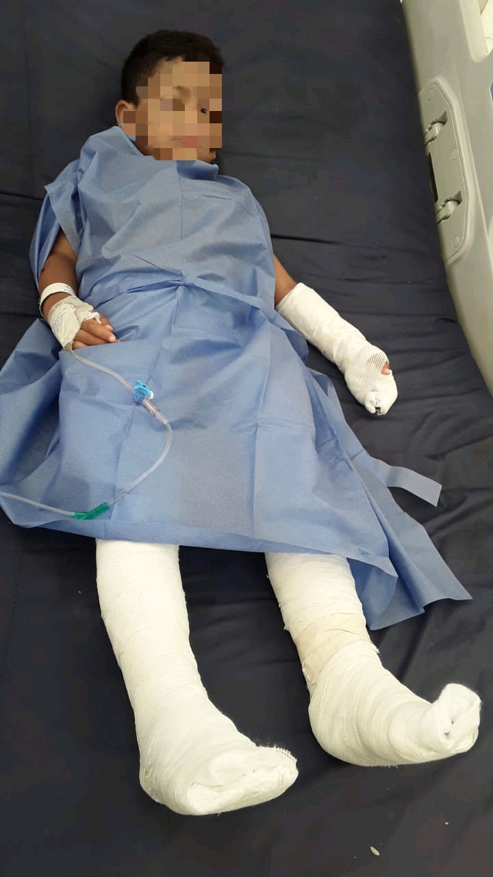 Menor atropellado