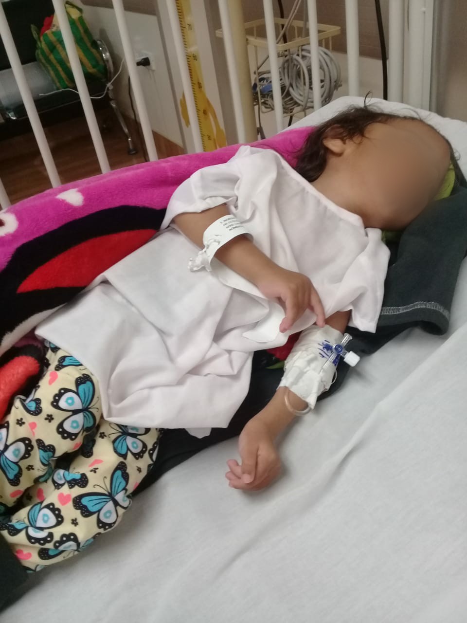 Niña con hidrocefalia