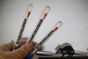 el-hantavirus-es-una-cepa-de-virus-transmitida-Z7ANBMQR6RAV5KMWGY2GEZQBD4.jpeg